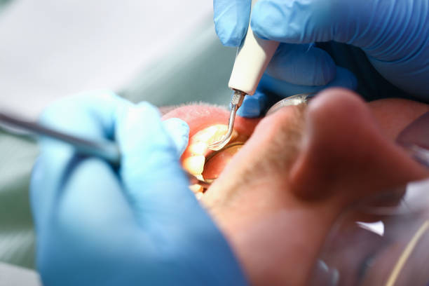 Best Emergency Treatment for Toothache in Campbell, MO