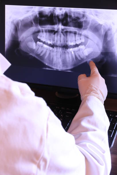 Best Emergency Tooth Extraction in Campbell, MO