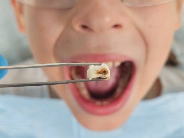Best Emergency Orthodontic Repairs in Campbell, MO