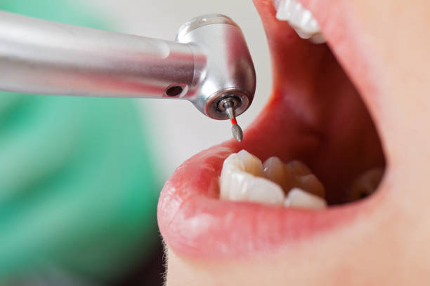 Best Weekend Emergency Dentist in Campbell, MO